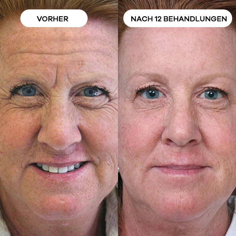 Before_After_12_2.webp__PID:babfd926-a666-4766-87cc-6c56ca51c874