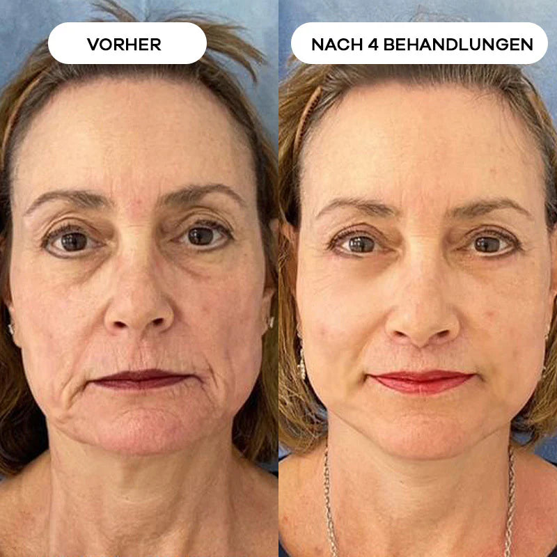 Before_After_4_1.webp__PID:2da0babf-d926-4666-8766-07cc6c56ca51