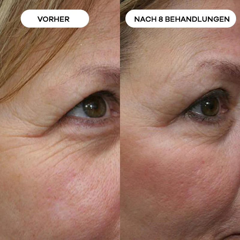 Before_After_8_1.webp__PID:a0babfd9-26a6-46c7-a607-cc6c56ca51c8